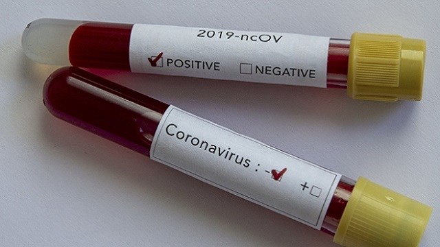 ukrayna-koronavirus-salgininda-ikinci-dalga-endisesini-yasiyor