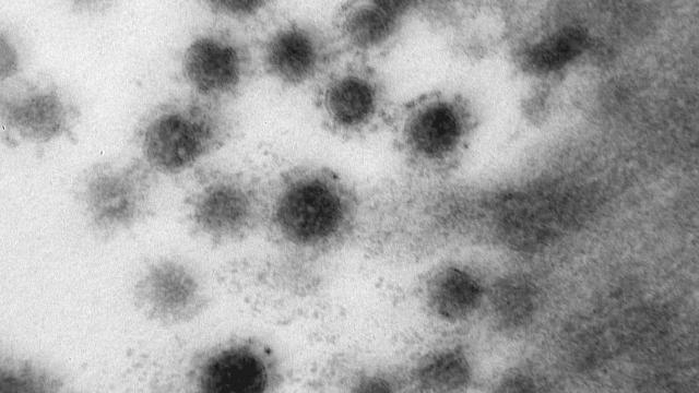 koronavirusun-delta-varyanti-rusyada-goruntulendi