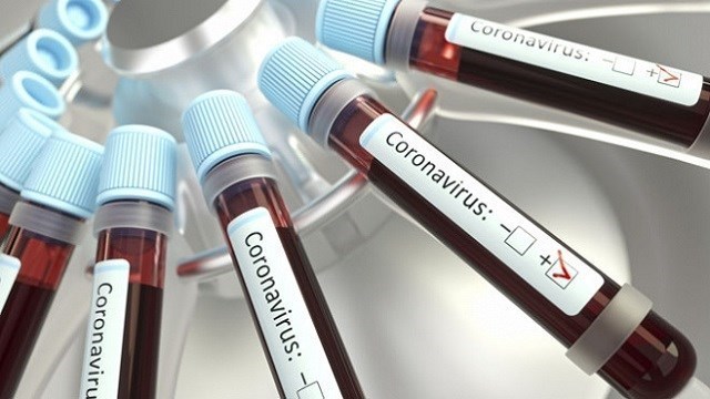 romanya-ab-ulkeleri-disindan-gelen-tum-yolculara-pcr-testi-zorunlulugu-getirdi